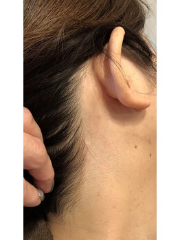 リュミエール(lash&brow lumiere)/うなじ脱毛