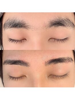 ミラ(MIRA)/《ハリウッドブロウリフト》