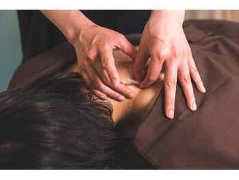 トリガー鍼灸 整体院 学芸大学駅前院(TRIGGER鍼灸 整体院)/肩甲骨周辺がゴリゴリする方