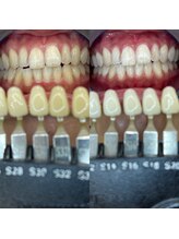トウキョウスワーズ 池袋店(TOKYO SWRS)/#ホワイトニング #池袋 #渋谷