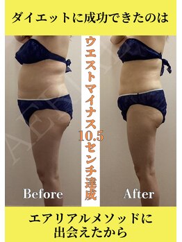 エアリアル 中津店/3ヶ月集中ダイエットに成功!