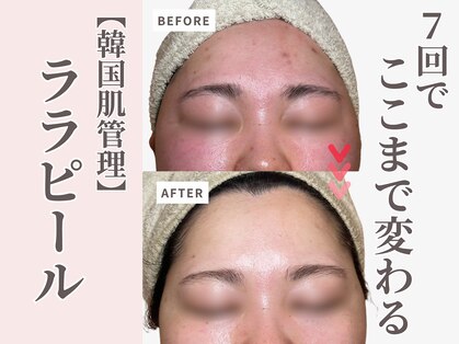 エングラッシー(en glassy)の写真