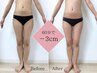 【脂肪撃退！】脂肪分解セラムで脂肪を徹底ケア◆70分38500円→27000円