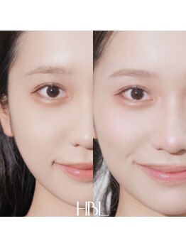 テンディ(TenD.)/【HBL】