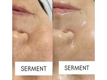 ロイヤル ビューティー サロン(Royal Beauty Saloon)の雰囲気（本物志向肌を育てる韓国肌管理[寝屋川/香里園]肌質改善）