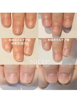 ニコプラス(NICO+)/