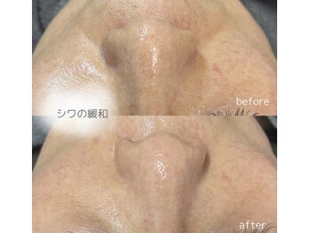 フロラスキン 心斎橋店(florasKIN)/しわたるみ改善プログラム