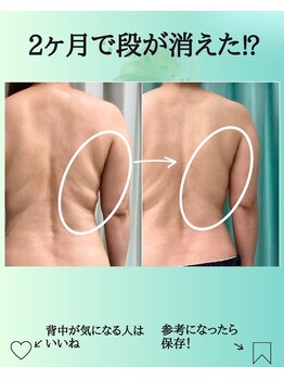 エデン(Eden)/ハミ肉や背中のぜい肉に