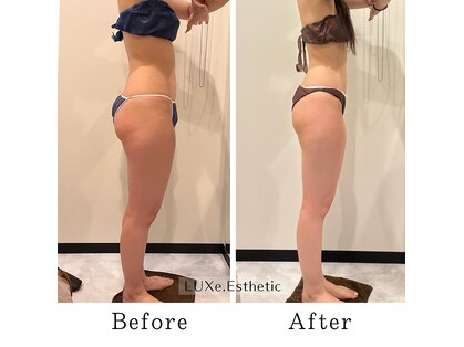 リュクスエステティック(LUXe. Esthetic)の写真