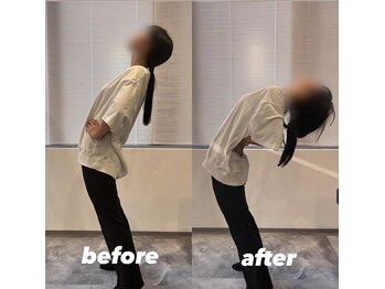 スリーエス 京都四条烏丸Studio(SSS)/実際の施術前後の変化2