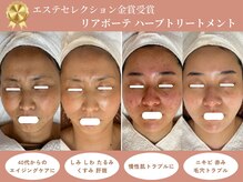 クラームビューティー(Clerm beauty)の雰囲気（エイジング悩み～慢性肌トラブルまで◎その肌悩み諦めないで!!）