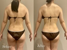 エステティック ミュー(Esthetic MiEUX)の雰囲気（痩身/ダイエット/お腹/足/全身痩せ/むくみケア/くびれ）