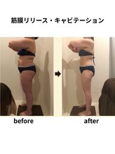 クリア(Clear)/筋膜リリース・キャビテーション