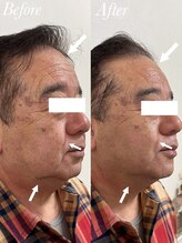 コリー(Kolly)/驚愕！初回で！