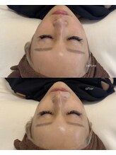 ベルーナビューティ 西新宿(Beluna beauty)/
