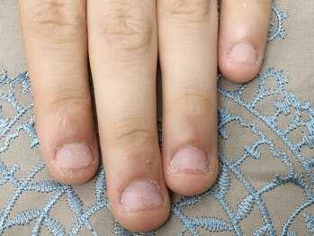 ネイルアンドアート イロオリ(irooori)/深爪でお困りのお客様もどうぞ。