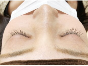 ボディキュア(BODYQA)/セラム使用前