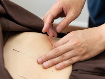 シュハリ(SHUHALI)の写真/極細鍼使用で痛みが少ないから初めての方にもオススメ◎美容鍼メニューのご用意あり♪男女OK！