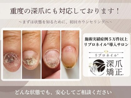 ローネイル(Raw nail)の写真
