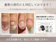 ローネイル(Raw nail)の写真