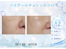 ユアーズ ビューティー(YOURS beauty)/ハイアールチューン