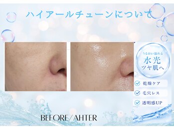 ユアーズ ビューティー(YOURS beauty)/ハイアールチューン