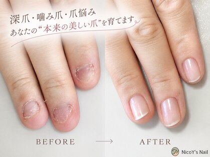 ニコワイズネイル(Nico Y's Nail)の写真