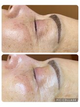 キラディ(KILADY)/肌質改善出来るコースが豊富！