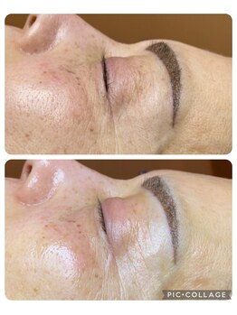 キラディ(KILADY)/肌質改善出来るコースが豊富！