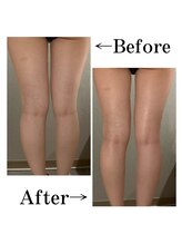 リプロ(RE:PRO)/整う骨盤&美脚美尻コース