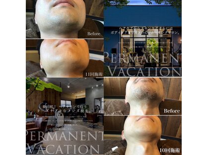 パーマネント バケーション(permanent vacation)の写真