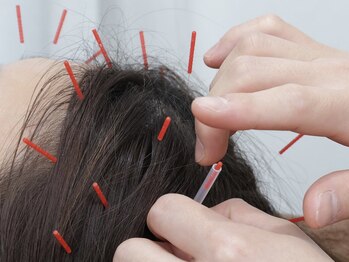 スプリング鍼灸院(Spring鍼灸院)/ストレスから解放されませんか？