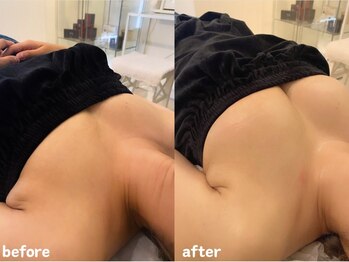 エムプリュ 心斎橋店(M.plus)/二の腕まで細くなる！