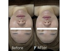 エムズビューティーサロン(M's Beauty Salon)/お客様Before After