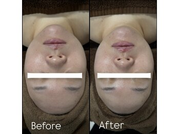 エムズビューティーサロン(M's Beauty Salon)/お客様Before After