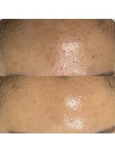 マリーメリー(marie merry)/セラピール