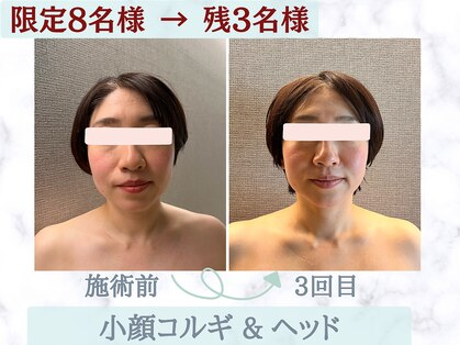 エンボディメントラボラトリー エイトレターズ(Embodiment Lab. 8 LETTERS)の写真