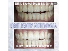 ライトビューティー 本八幡店(LIGHT BEAUTY)/自然な白さでキープも可能です♪