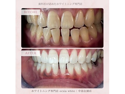 エクシアホワイトニング 札幌琴似店の写真