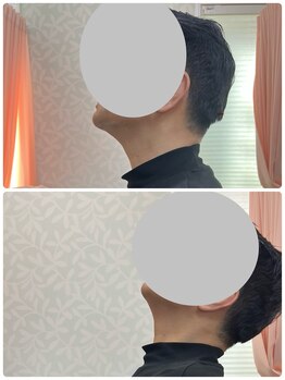 しもえのお整骨院/首の痛みも一度で…