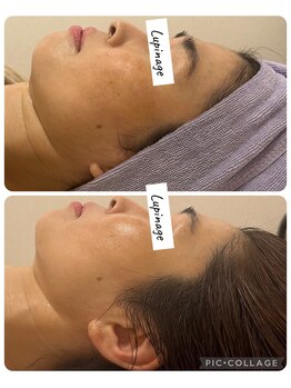 ルピナージュ(Lupinage)/小顔フェイシャル