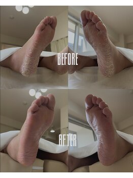 おん/乾燥した足裏