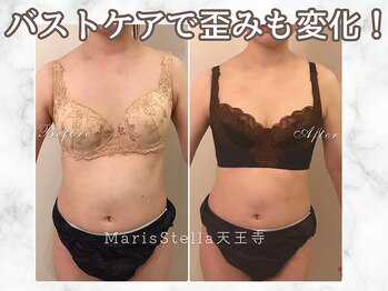 マリスステラ 天王寺(MarisStella)/バストケアで歪みも改善！