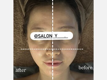 サロンワイアネシス(Salon y ANESIS)/小顔コルギ