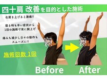 ユーストレッチ(U-STRETCH)の雰囲気(【お悩みを根本から】★肩のお悩み根本改善)