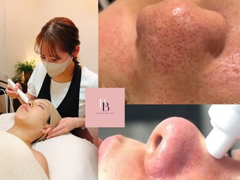 フォトビズの写真/毛穴集中ケア都度払い肌育サロン【毛穴レス＆艶肌肌育】フォト＋ハイドラ毛穴洗浄+ヒト幹細胞パックが人気