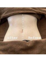 サロンドビジュー(salon de bijou)/ホットストーン×痩身