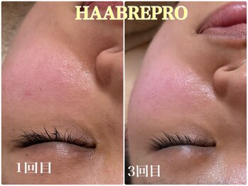 ベルシャトン(Belle Chaton)/