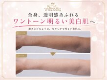 ロイヤルホワイトニング銀座 銀座本店