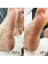 プリンセスローズ 焼津店(Princess Rose)/角質ケア